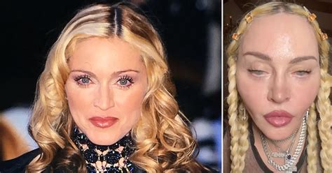 madonna plastic surgery photos|Madonna’s face, then and now: 19 pictures of her changing look.